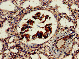 Immunohistochemistry of paraffin-embedded human lung tissue using AKT1S1 Antibody at dilution of 1:100Rabbit anti-Human AKT1S1 Polyclonal Antibody