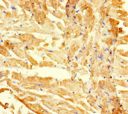 Immunohistochemistry of paraffin-embedded human heart tissue using RGMA Antibody at dilution of 1:100Rabbit anti-Human RGMA Polyclonal Antibody