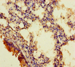 Immunohistochemistry of paraffin-embedded human lung tissue using RGMA Antibody at dilution of 1:100Rabbit anti-Human RGMA Polyclonal Antibody