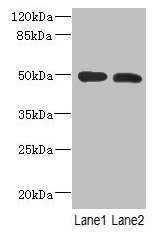 Western Blot  | All lanes: RGMA antibody at 12µg/ml  | Lane 1: Mouse brain tissue  | Lane 2: Hela whole cell lysate  | Secondary  | Goat polyclonal to rabbit IgG at 1/10000 dilution  | Predicted band size: 50, 48, 51 kDa  | Observed band size: 50 kDaRabbit anti-Human RGMA Polyclonal Antibody