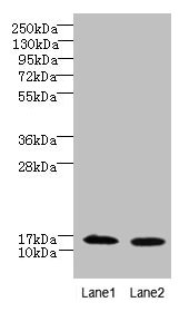 Western blot  | All lanes: FAM136A antibody at 8µg/ml  | Lane 1: Hela whole cell lysate  | Lane 2: Caco-2 whole cell lysate  | Secondary  | Goat polyclonal to rabbit IgG at 1/10000 dilution  | Predicted band size: 16 kDa  | Observed band size: 16 kDaRabbit anti-Human FAM136A Polyclonal Antibody