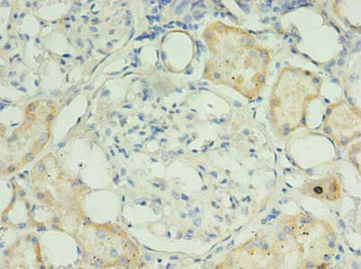 Immunohistochemistry of paraffin-embedded human kidney tissue using RPUSD4 Antibody at dilution of 1:100Rabbit anti-Human RPUSD4 Polyclonal Antibody