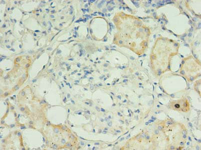 Immunohistochemistry of paraffin-embedded human kidney tissue using RPUSD4 Antibody at dilution of 1:100Rabbit anti-Human RPUSD4 Polyclonal Antibody