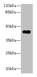 Western blot  | All lanes: RPUSD4 antibody at 0.5µg/ml + MCF-7 whole cell lysate  | Secondary  | Goat polyclonal to rabbit IgG at 1/10000 dilution  | Predicted band size: 43, 39 kDa  | Observed band size: 43 kDaRabbit anti-Human RPUSD4 Polyclonal Antibody