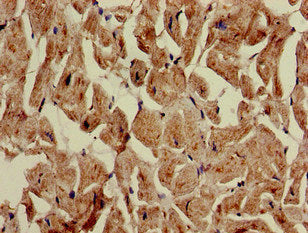 Immunohistochemistry of paraffin-embedded human heart tissue using ATG4C Antibody at dilution of 1:100