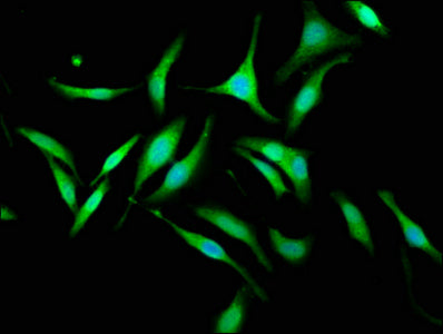 Immunofluorescence staining of Hela cells with KIF1BP Antibody at 1:133, counter-stained with DAPI. The cells were fixed in 4% formaldehyde, permeabilized using 0.2% Triton X-100 and blocked in 10% normal Goat Serum. The cells were then incubated with the antibody overnight at 4°C. The secondary antibody was Alexa Fluor 488-congugated AffiniPure Goat Anti-Rabbit IgG(H+L).