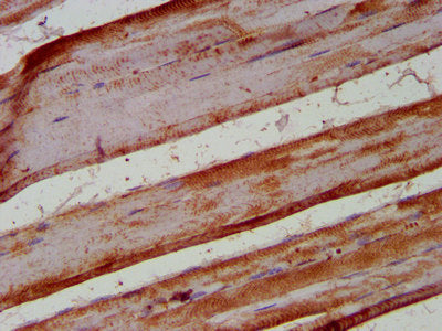 IHC image of KIF1BP Antibody diluted at 1:400 and staining in paraffin-embedded human skeletal muscle tissue performed on a Leica BondTM system. After dewaxing and hydration, antigen retrieval was mediated by high pressure in a citrate buffer (pH 6.0). Section was blocked with 10% normal goat serum 30min at RT. Then primary antibody (1% BSA) was incubated at 4°C overnight. The primary is detected by a biotinylated secondary antibody and visualized using an HRP conjugated SP system.