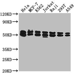Western Blot  | Positive WB detected in: Hela whole cell lysate, MCF-7 whole cell lysate, K562 whole cell lysate, Jurkat whole cell lysate, Raji whole cell lysate, 293T whole cell lysate, A549 whole cell lysate  | All lanes: DNAJA3 antibody at 1:2000  | Secondary  | Goat polyclonal to rabbit IgG at 1/50000 dilution  | Predicted band size: 53, 50, 34 kDa  | Observed band size: 53 kDaRabbit anti-Human DNAJA3 Polyclonal Antibody
