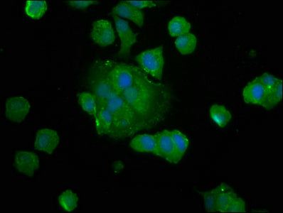 Immunofluorescence staining of MCF-7 cells with SAT2 Antibody at 1:133, counter-stained with DAPI. The cells were fixed in 4% formaldehyde, permeabilized using 0.2% Triton X-100 and blocked in 10% normal Goat Serum. The cells were then incubated with the antibody overnight at 4°C. The secondary antibody was Alexa Fluor 488-congugated AffiniPure Goat Anti-Rabbit IgG(H+L).Rabbit anti-Human SAT2 Polyclonal Antibody