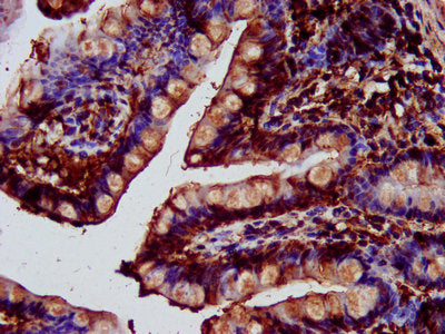 IHC image of the antibody diluted at 1:400 and staining in paraffin-embedded human small intestine tissue performed on a Leica BondTM system. After dewaxing and hydration, antigen retrieval was mediated by high pressure in a citrate buffer (pH 6.0). Section was blocked with 10% normal goat serum 30min at RT. Then primary antibody (1% BSA) was incubated at 4°C overnight. The primary is detected by a biotinylated secondary antibody and visualized using an HRP conjugated SP system.Rabbit anti-Human SAT2 Polyclonal Antibody