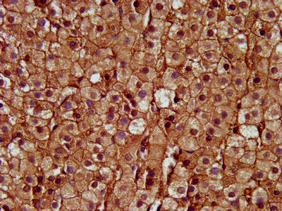 IHC image of SAT2 Antibody diluted at 1:400 and staining in paraffin-embedded human adrenal gland tissue performed on a Leica BondTM system. After dewaxing and hydration, antigen retrieval was mediated by high pressure in a citrate buffer (pH 6.0). Section was blocked with 10% normal goat serum 30min at RT. Then primary antibody (1% BSA) was incubated at 4°C overnight. The primary is detected by a biotinylated secondary antibody and visualized using an HRP conjugated SP system.Rabbit anti-Human SAT2 Polyclonal Antibody