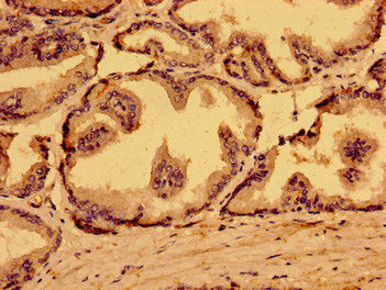Immunohistochemistry of paraffin-embedded human prostate tissue using MARS2 Antibody at dilution of 1:100