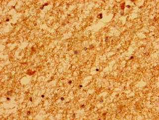 Immunohistochemistry of paraffin-embedded human brain tissue using MARS2 Antibody at dilution of 1:100