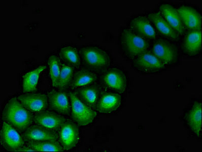 Immunofluorescent analysis of A549 cells using VPS39 Antibody at dilution of 1:100 and Alexa Fluor 488-congugated AffiniPure Goat Anti-Rabbit IgG(H+L)Rabbit anti-Human VPS39 Polyclonal Antibody