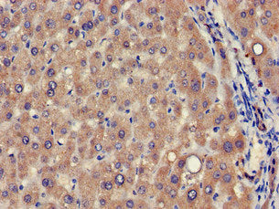 Immunohistochemistry of paraffin-embedded human liver tissue using VPS39 Antibody at dilution of 1:100Rabbit anti-Human VPS39 Polyclonal Antibody