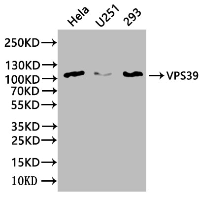 Western Blot | Positive WB detected in: Mouse heart tissue, Mouse kidney tissue | All lanes: VPS39 antibody at 3μg/ml | Secondary | Goat polyclonal to rabbit IgG at 1/50000 dilution | Predicted band size: 102, 101 kDa | Observed band size: 102 kDaRabbit anti-Human VPS39 Polyclonal Antibody