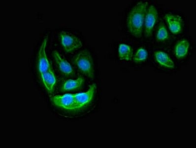 Immunofluorescent analysis of A549 cells using ELMO2 Antibody at dilution of 1:100 and Alexa Fluor 488-congugated AffiniPure Goat Anti-Rabbit IgG(H+L)