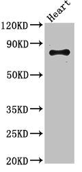 Western Blot | Positive WB detected in: Mouse heart tissue | All lanes: ELMO2 antibody at 3.4μg/ml | Secondary | Goat polyclonal to rabbit IgG at 1/50000 dilution | Predicted band size: 83, 73 kDa | Observed band size: 83 kDa