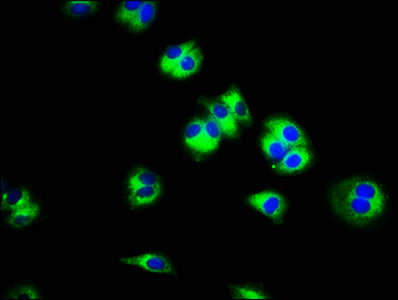 Immunofluorescence staining of HepG2 cells with SLC45A3 Antibody at 1:100, counter-stained with DAPI. The cells were fixed in 4% formaldehyde, permeabilized using 0.2% Triton X-100 and blocked in 10% normal Goat Serum. The cells were then incubated with the antibody overnight at 4°C. The secondary antibody was Alexa Fluor 488-congugated AffiniPure Goat Anti-Rabbit IgG(H+L).Rabbit anti-Human SLC45A3 Polyclonal Antibody