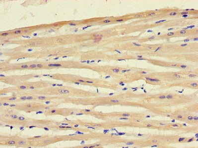 Immunohistochemistry of paraffin-embedded human heart tissue using ART5 Antibody at dilution of 1:100Rabbit anti-Human ART5 Polyclonal Antibody
