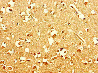 Immunohistochemistry of paraffin-embedded human brain tissue using ART5 Antibody at dilution of 1:100Rabbit anti-Human ART5 Polyclonal Antibody