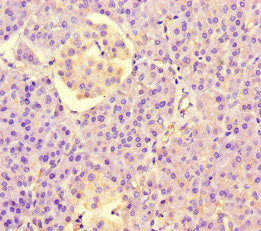 Immunohistochemistry of paraffin-embedded human pancreatic tissue using LRR1 Antibody at dilution of 1:100