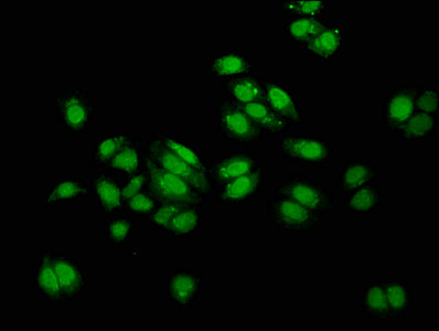 Immunofluorescence staining of HepG2 cells with MUS81 Antibody at 1:100, counter-stained with DAPI. The cells were fixed in 4% formaldehyde, permeabilized using 0.2% Triton X-100 and blocked in 10% normal Goat Serum. The cells were then incubated with the antibody overnight at 4°C. The secondary antibody was Alexa Fluor 488-congugated AffiniPure Goat Anti-Rabbit IgG(H+L).Rabbit anti-Human MUS81 Polyclonal Antibody
