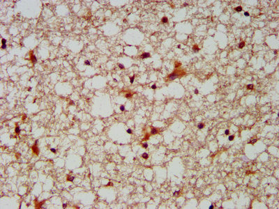 IHC image of the antibody diluted at 1:300 and staining in paraffin-embedded human brain tissue performed on a Leica BondTM system. After dewaxing and hydration, antigen retrieval was mediated by high pressure in a citrate buffer (pH 6.0). Section was blocked with 10% normal goat serum 30min at RT. Then primary antibody (1% BSA) was incubated at 4°C overnight. The primary is detected by a biotinylated secondary antibody and visualized using an HRP conjugated SP system.Rabbit anti-Human MUS81 Polyclonal Antibody