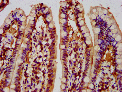 IHC image of MUS81 Antibody diluted at 1:300 and staining in paraffin-embedded human small intestine tissue performed on a Leica BondTM system. After dewaxing and hydration, antigen retrieval was mediated by high pressure in a citrate buffer (pH 6.0). Section was blocked with 10% normal goat serum 30min at RT. Then primary antibody (1% BSA) was incubated at 4°C overnight. The primary is detected by a biotinylated secondary antibody and visualized using an HRP conjugated SP system.Rabbit anti-Human MUS81 Polyclonal Antibody