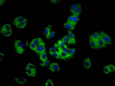 Immunofluorescence staining of HepG2 cells with MOGAT1 Antibody at 1:100, counter-stained with DAPI. The cells were fixed in 4% formaldehyde, permeabilized using 0.2% Triton X-100 and blocked in 10% normal Goat Serum. The cells were then incubated with the antibody overnight at 4°C. The secondary antibody was Alexa Fluor 488-congugated AffiniPure Goat Anti-Rabbit IgG(H+L).Rabbit anti-Human MOGAT1 Polyclonal Antibody