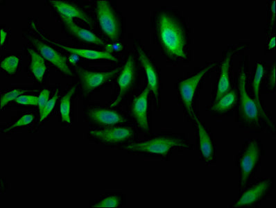 Immunofluorescence staining of Hela cells with NEK1 Antibody at 1:100, counter-stained with DAPI. The cells were fixed in 4% formaldehyde, permeabilized using 0.2% Triton X-100 and blocked in 10% normal Goat Serum. The cells were then incubated with the antibody overnight at 4°C. The secondary antibody was Alexa Fluor 488-congugated AffiniPure Goat Anti-Rabbit IgG(H+L).Rabbit anti-Human NEK1 Polyclonal Antibody
