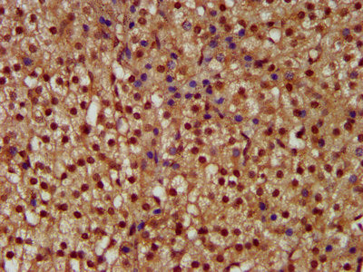 IHC image of the antibody diluted at 1:300 and staining in paraffin-embedded human adrenal gland tissue performed on a Leica BondTM system. After dewaxing and hydration, antigen retrieval was mediated by high pressure in a citrate buffer (pH 6.0). Section was blocked with 10% normal goat serum 30min at RT. Then primary antibody (1% BSA) was incubated at 4°C overnight. The primary is detected by a biotinylated secondary antibody and visualized using an HRP conjugated SP system.Rabbit anti-Human NEK1 Polyclonal Antibody