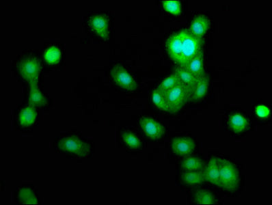 Immunofluorescence staining of HepG2 cells with TRIB1 Antibody at 1:166, counter-stained with DAPI. The cells were fixed in 4% formaldehyde, permeabilized using 0.2% Triton X-100 and blocked in 10% normal Goat Serum. The cells were then incubated with the antibody overnight at 4°C. The secondary antibody was Alexa Fluor 488-congugated AffiniPure Goat Anti-Rabbit IgG(H+L).Rabbit anti-Human TRIB1 Polyclonal Antibody