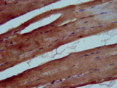 IHC image of TRIB1 Antibody diluted at 1:500 and staining in paraffin-embedded human skeletal muscle tissue performed on a Leica BondTM system. After dewaxing and hydration, antigen retrieval was mediated by high pressure in a citrate buffer (pH 6.0). Section was blocked with 10% normal goat serum 30min at RT. Then primary antibody (1% BSA) was incubated at 4°C overnight. The primary is detected by a biotinylated secondary antibody and visualized using an HRP conjugated SP system.Rabbit anti-Human TRIB1 Polyclonal Antibody