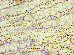 Immunohistochemistry of paraffin-embedded human colon tissue using KCTD15 Antibody at dilution of 1:100