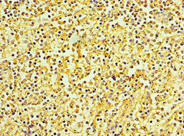 Immunohistochemistry of paraffin-embedded human spleen tissue using KCTD15 Antibody at dilution of 1:100
