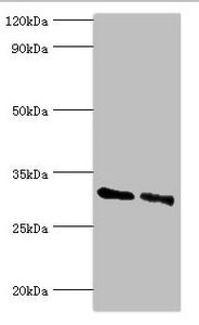 Western blot | All lanes: KCTD15 antibody at 8μg/ml | Lane 1: 293T whole cell lysate | Lane 2: Hela whole cell lysate | Secondary | Goat polyclonal to rabbit IgG at 1/10000 dilution | Predicted band size: 32, 27 kDa | Observed band size: 32 kDa