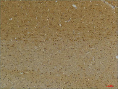 Immunohistochemical analysis of paraffin-embedded Rat BrainTissue using KCNK9 (TASK-3) Rabbit pAb diluted at 1:200.