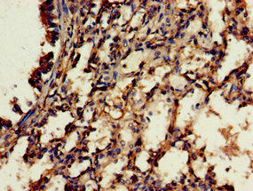 Immunohistochemistry of paraffin-embedded human lung tissue using RBFA Antibody at dilution of 1:100Rabbit anti-Human RBFA Polyclonal Antibody