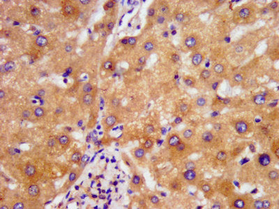 IHC image of NDUFAF2 Antibody diluted at 1:500 and staining in paraffin-embedded human liver tissue performed on a Leica BondTM system. After dewaxing and hydration, antigen retrieval was mediated by high pressure in a citrate buffer (pH 6.0). Section was blocked with 10% normal goat serum 30min at RT. Then primary antibody (1% BSA) was incubated at 4°C overnight. The primary is detected by a biotinylated secondary antibody and visualized using an HRP conjugated SP system.Rabbit anti-Human NDUFAF2 Polyclonal Antibody