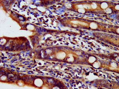 IHC image of NDUFAF2 Antibody diluted at 1:500 and staining in paraffin-embedded human small intestine tissue performed on a Leica BondTM system. After dewaxing and hydration, antigen retrieval was mediated by high pressure in a citrate buffer (pH 6.0). Section was blocked with 10% normal goat serum 30min at RT. Then primary antibody (1% BSA) was incubated at 4°C overnight. The primary is detected by a biotinylated secondary antibody and visualized using an HRP conjugated SP system.Rabbit anti-Human NDUFAF2 Polyclonal Antibody