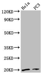 Western Blot  | Positive WB detected in: Hela whole cell lysate, PC-3 whole cell lysate  | All lanes: NDUFAF2 antibody at 2.7µg/ml  | Secondary  | Goat polyclonal to rabbit IgG at 1/50000 dilution  | Predicted band size: 20 kDa  | Observed band size: 20 kDaRabbit anti-Human NDUFAF2 Polyclonal Antibody