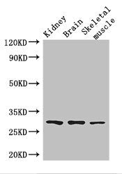 Western Blot | Positive WB detected in: Mouse kidney tissue, Mouse brain tissue, Mouse skeletal muscle tissue | All lanes: PLD6 antibody at 2.5μg/ml | Secondary | Goat polyclonal to rabbit IgG at 1/50000 dilution | Predicted band size: 29 kDa | Observed band size: 29 kDaRabbit anti-Human PLD6 Polyclonal Antibody