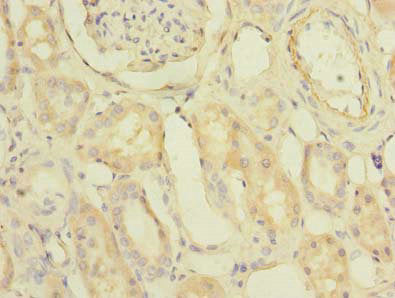 Immunohistochemistry of paraffin-embedded human kidney tissue using PDCL2 Antibody at dilution of 1:100Rabbit anti-Human PDCL2 Polyclonal Antibody