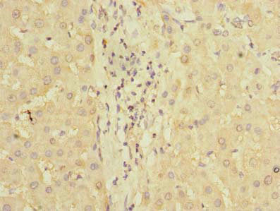 Immunohistochemistry of paraffin-embedded human liver tissue using PDCL2 Antibody at dilution of 1:100Rabbit anti-Human PDCL2 Polyclonal Antibody