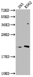 Western Blot | Positive WB detected in: 293 whole cell lysate, K562 whole cell lysate | All lanes: HDDC3 antibody at 1:2000 | Secondary | Goat polyclonal to rabbit IgG at 1/50000 dilution | Predicted band size: 21, 16 kDa | Observed band size: 21 kDaRabbit anti-Human HDDC3 Polyclonal Antibody