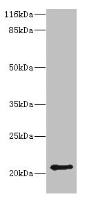 Western blot | All lanes: HDDC3 antibody at 2μg/ml + Mouse heart tissue | Secondary | Goat polyclonal to rabbit IgG at 1/10000 dilution | Predicted band size: 21, 16 kDa | Observed band size: 21 kDaRabbit anti-Human HDDC3 Polyclonal Antibody