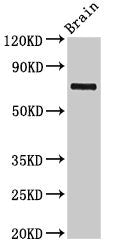 Western Blot  | Positive WB detected in: Rat brain tissue  | All lanes: L3MBTL4 antibody at 3µg/ml  | Secondary  | Goat polyclonal to rabbit IgG at 1/50000 dilution  | Predicted band size: 72, 62 kDa  | Observed band size: 72 kDa
