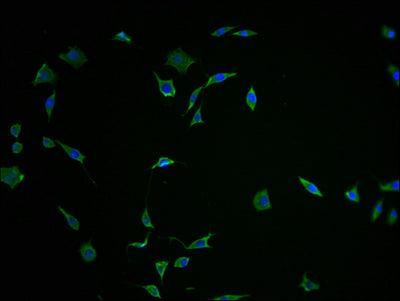 Immunofluorescence staining of SH-SY5Y cells with FNDC5 Antibody-IF at 1:100, counter-stained with DAPI. The cells were fixed in 4% formaldehyde and blocked in 10% normal Goat Serum. The cells were then incubated with the antibody overnight at 4°C. The secondary antibody was Alexa Fluor 488-congugated AffiniPure Goat Anti-Rabbit IgG(H+L).Rabbit anti-Human FNDC5 Polyclonal Antibody
