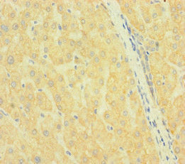 Immunohistochemistry of paraffin-embedded human liver tissue using SLC38A9 Antibody at dilution of 1:100Rabbit anti-Human SLC38A9 Polyclonal Antibody
